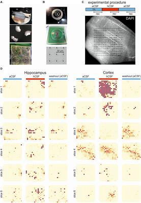 Human Cerebrospinal Fluid Induces Neuronal Excitability Changes in Resected Human Neocortical and Hippocampal Brain Slices